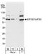 Eukaryotic Translation Initiation Factor 3 Subunit D antibody, A301-759A, Bethyl Labs, Western Blot image 