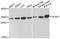 Sideroflexin 1 antibody, STJ114820, St John