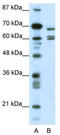 Potassium channel subfamily K member 5 antibody, TA331458, Origene, Western Blot image 