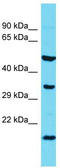 Heat Shock Protein Nuclear Import Factor Hikeshi antibody, TA345029, Origene, Western Blot image 