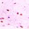 Id-3 antibody, LS-C667767, Lifespan Biosciences, Immunohistochemistry paraffin image 