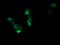 RCAN Family Member 3 antibody, LS-C787655, Lifespan Biosciences, Immunofluorescence image 