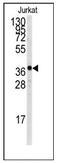 TAL BHLH Transcription Factor 1, Erythroid Differentiation Factor antibody, AP12390PU-N, Origene, Western Blot image 