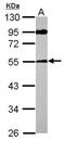 Sperm-associated antigen 8 antibody, GTX122115, GeneTex, Western Blot image 