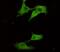 Ubiquitin C-Terminal Hydrolase L1 antibody, GTX49143, GeneTex, Immunocytochemistry image 