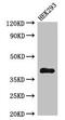 Dehydrogenase/Reductase 13 antibody, CSB-PA761493LA01HU, Cusabio, Western Blot image 