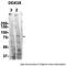 DEAD-Box Helicase 3 X-Linked antibody, TA341555, Origene, Western Blot image 