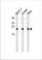 O-6-Methylguanine-DNA Methyltransferase antibody, TA328166, Origene, Western Blot image 