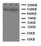 Cadherin 5 antibody, LS-C313199, Lifespan Biosciences, Western Blot image 