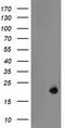 LDOC1 Regulator Of NFKB Signaling antibody, TA505057BM, Origene, Western Blot image 