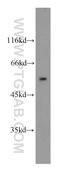 Patatin Like Phospholipase Domain Containing 3 antibody, 11442-1-AP, Proteintech Group, Western Blot image 