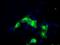 Scianna blood group antigen antibody, GTX84543, GeneTex, Immunocytochemistry image 