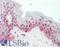 Cyclin D1 antibody, LS-B11492, Lifespan Biosciences, Immunohistochemistry frozen image 