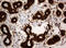 SERPINE1 MRNA Binding Protein 1 antibody, LS-C788960, Lifespan Biosciences, Immunohistochemistry paraffin image 