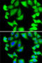 Ribosomal Protein S5 antibody, 22-598, ProSci, Immunofluorescence image 