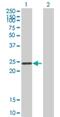 Serine/Threonine/Tyrosine Interacting Protein antibody, H00006815-B01P, Novus Biologicals, Western Blot image 