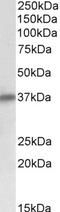 Sarcoglycan Delta antibody, EB10758, Everest Biotech, Western Blot image 