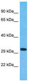 Olfactory Receptor Family 6 Subfamily N Member 2 antibody, TA337540, Origene, Western Blot image 