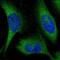 Kelch Like Family Member 28 antibody, NBP1-90748, Novus Biologicals, Immunofluorescence image 