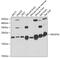 NADH dehydrogenase [ubiquinone] iron-sulfur protein 4, mitochondrial antibody, 15-038, ProSci, Western Blot image 
