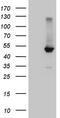 Nuclear Receptor Subfamily 1 Group H Member 4 antibody, LS-C794833, Lifespan Biosciences, Western Blot image 