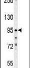 Enamelin antibody, PA5-25734, Invitrogen Antibodies, Western Blot image 