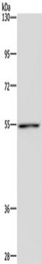 Cytochrome P450 Family 1 Subfamily A Member 1 antibody, TA351483, Origene, Western Blot image 
