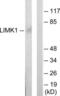 LIM domain kinase 1 antibody, LS-C118939, Lifespan Biosciences, Western Blot image 