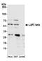 Lamina-associated polypeptide 2, isoforms beta/gamma antibody, A304-850A, Bethyl Labs, Western Blot image 