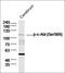 ABL Proto-Oncogene 1, Non-Receptor Tyrosine Kinase antibody, orb156226, Biorbyt, Western Blot image 