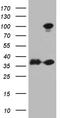 Eukaryotic Translation Elongation Factor 1 Delta antibody, CF811675, Origene, Western Blot image 