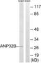 Acidic Nuclear Phosphoprotein 32 Family Member B antibody, TA312317, Origene, Western Blot image 