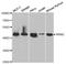 Ribonucleotide Reductase Regulatory Subunit M2 antibody, TA327571, Origene, Western Blot image 