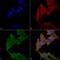 Unc-51 Like Autophagy Activating Kinase 1 antibody, LS-C773177, Lifespan Biosciences, Immunocytochemistry image 