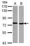 ENaCD antibody, NBP2-20271, Novus Biologicals, Western Blot image 