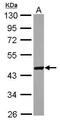 Sperm Associated Antigen 6 antibody, GTX115259, GeneTex, Western Blot image 
