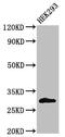 KChIP3 antibody, CSB-PA012045LA01HU, Cusabio, Western Blot image 