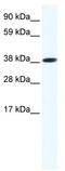 OBOX6 antibody, TA329586, Origene, Western Blot image 