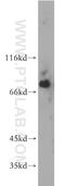 Bruton Tyrosine Kinase antibody, 21581-1-AP, Proteintech Group, Western Blot image 