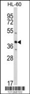 ST8 Alpha-N-Acetyl-Neuraminide Alpha-2,8-Sialyltransferase 2 antibody, LS-C161533, Lifespan Biosciences, Western Blot image 