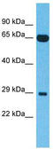 Family With Sequence Similarity 227 Member B antibody, TA338894, Origene, Western Blot image 