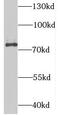 Suv3 Like RNA Helicase antibody, FNab08397, FineTest, Western Blot image 
