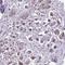 V-Set Domain Containing T Cell Activation Inhibitor 1 antibody, HPA054200, Atlas Antibodies, Immunohistochemistry paraffin image 