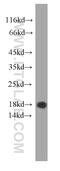 Myosin regulatory light chain 2, ventricular/cardiac muscle isoform antibody, 60229-1-Ig, Proteintech Group, Western Blot image 