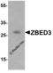 Zinc Finger BED-Type Containing 3 antibody, 5113, ProSci, Western Blot image 