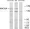 Ankyrin Repeat Domain 30A antibody, GTX87467, GeneTex, Western Blot image 