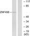 Zinc Finger And SCAN Domain Containing 25 antibody, TA316257, Origene, Western Blot image 