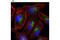 Lysosomal Associated Membrane Protein 1 antibody, 9091T, Cell Signaling Technology, Immunofluorescence image 