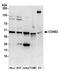 CCNE2 antibody, A305-275A, Bethyl Labs, Western Blot image 