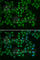 Bruton Tyrosine Kinase antibody, A1576, ABclonal Technology, Immunofluorescence image 